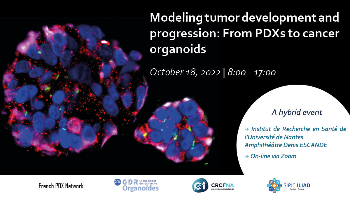 Tumor Modeling Modeling tumor development and progression: From PDXs to cancer ...
